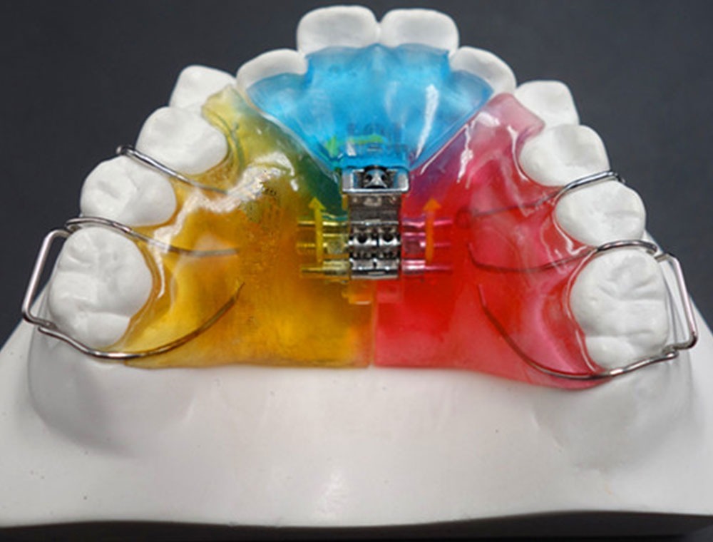 Orthodontische toestellen