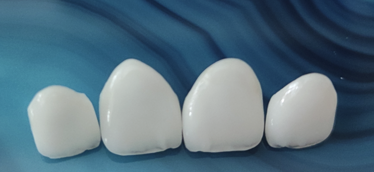 Facings