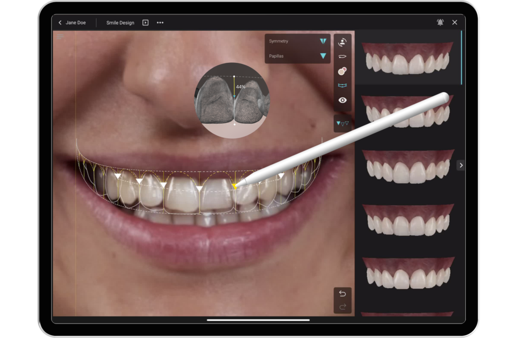 Digitaal ontwerp en Smile Cloud
